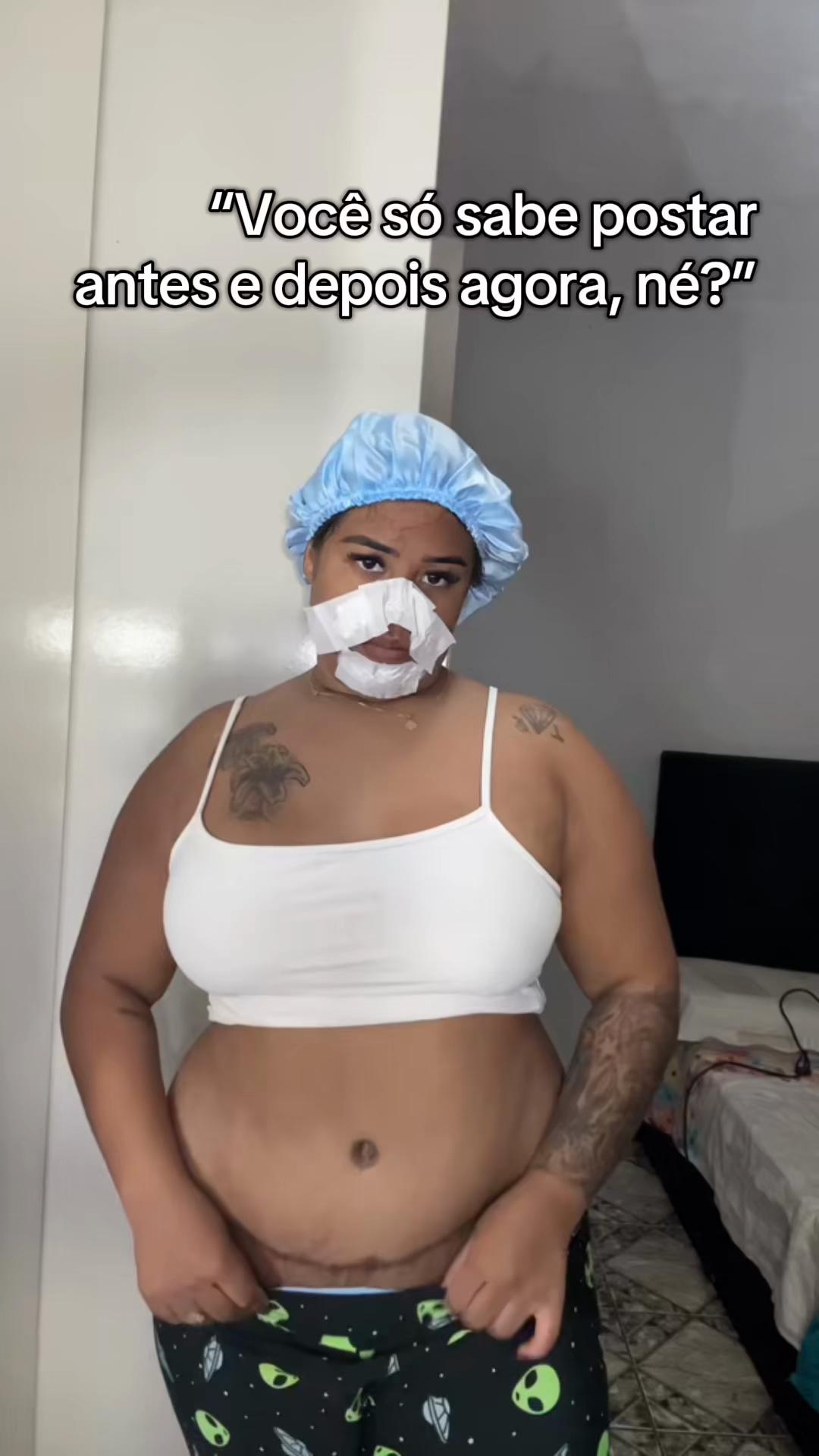 lipoless - Video 53