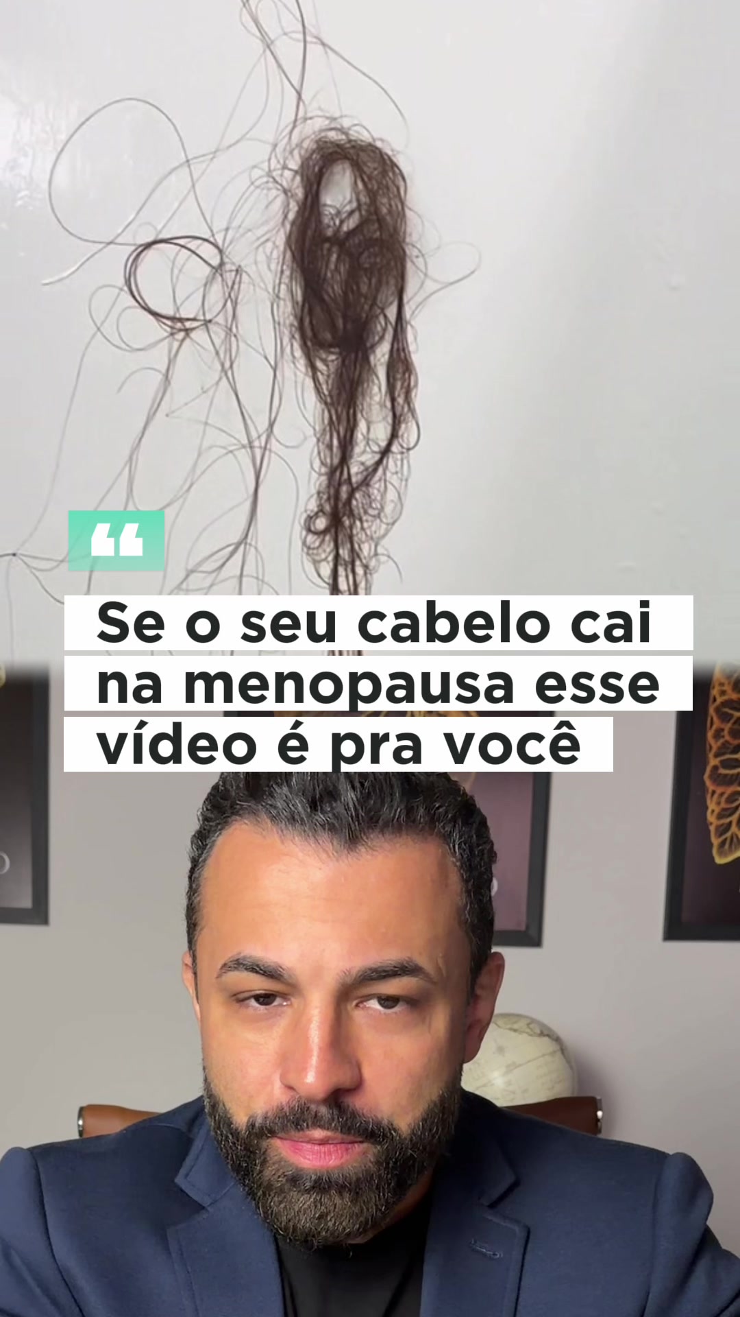 dr.marcelo.santos - Video 51
